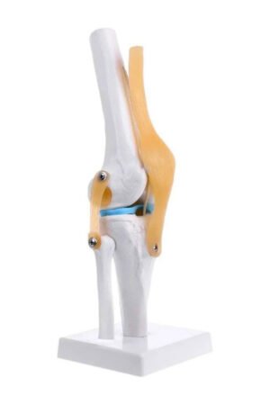 مجسم ركبه بالغضاريف