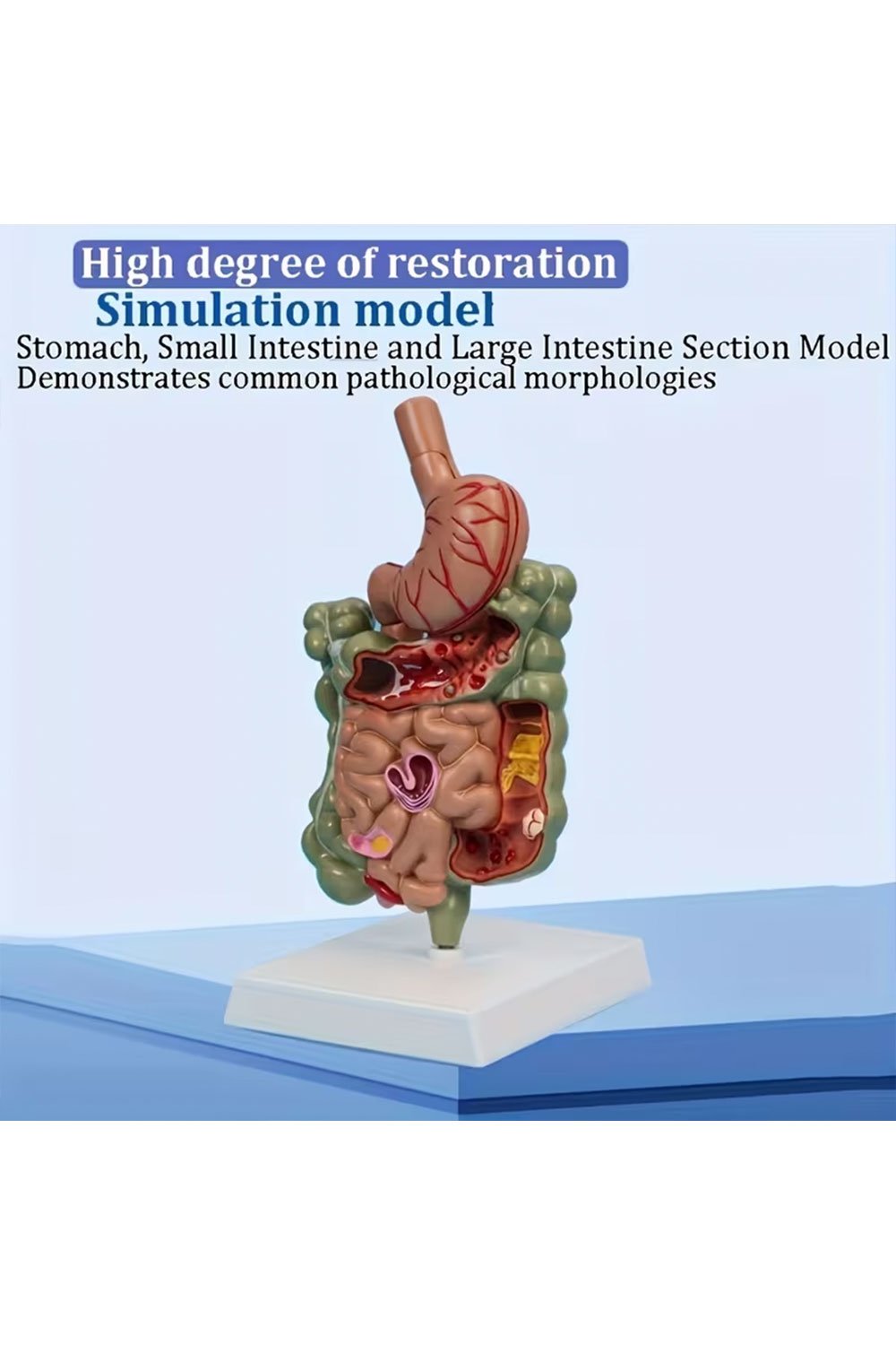 نموذج تشريحي للمعدة البشرية - الصورة 4