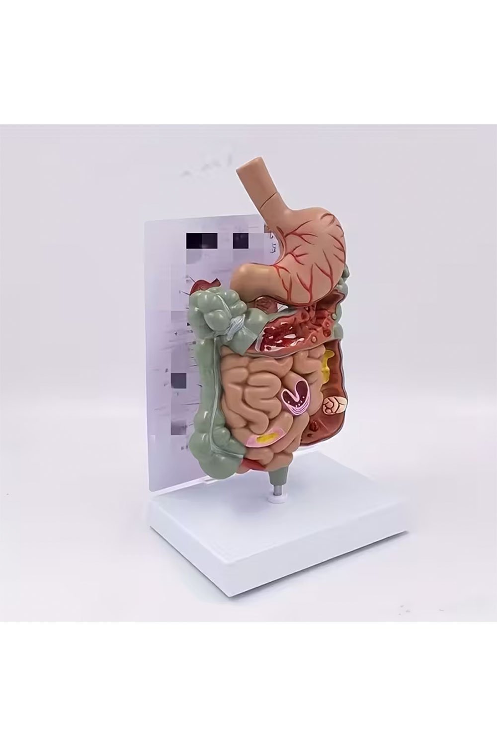 نموذج تشريحي للمعدة البشرية - الصورة 7