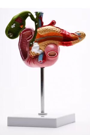 نموذج تعليمي تشريحي للبنكرياس والاثني عشر والمرارة والحصى