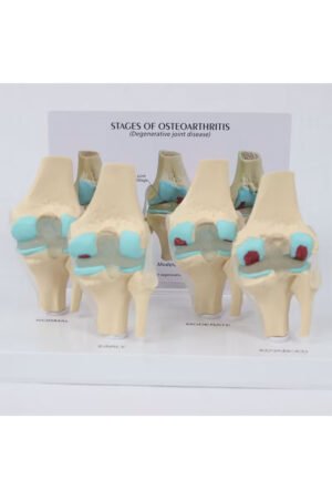 نموذج مفصل الركبة