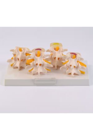 نموذج الفقرات القطنية