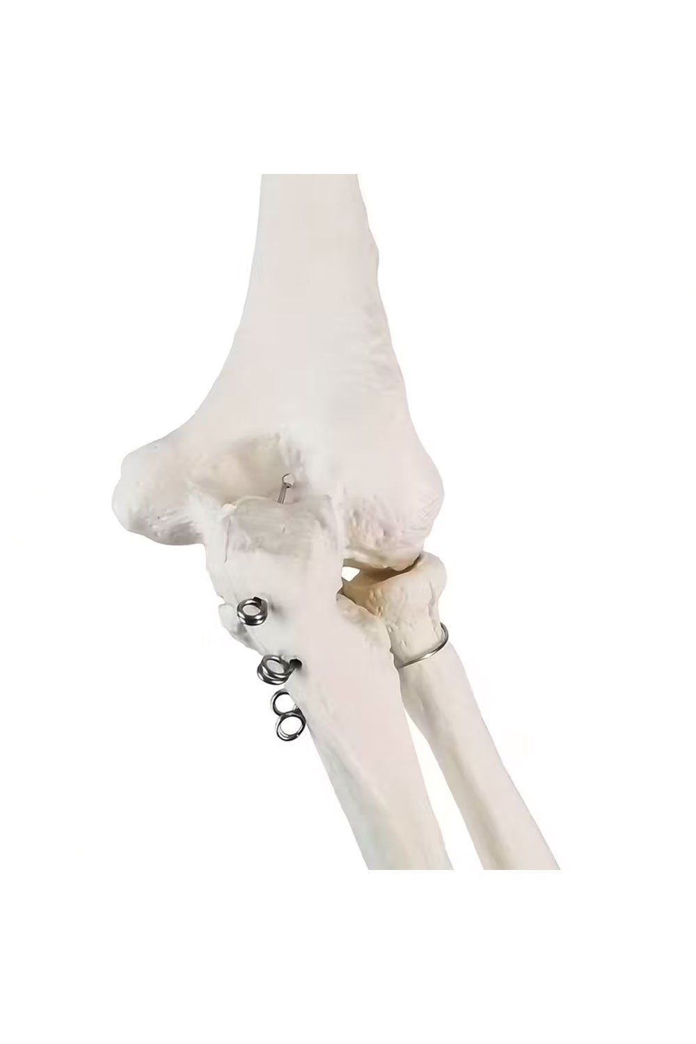 نموذج هيكل عظمي للطرف العلوي - الصورة 4